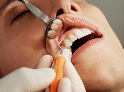 Dentist Appointment for Gingivitis