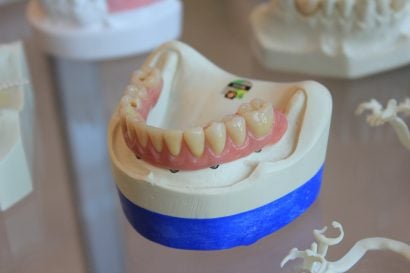 Dental plaque prosthesis