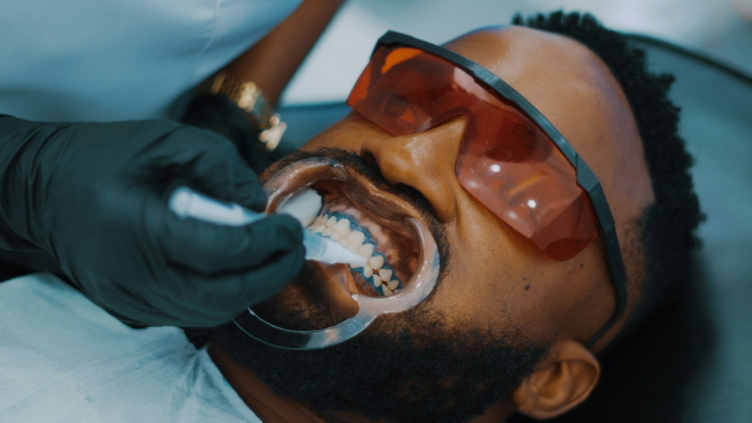 Laser Teeth Whitening